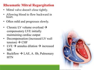 rheumatic fever in children.pdf