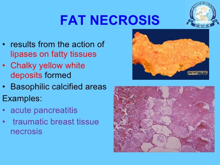 11.20 (dr. yasmeen hashim) apoptosis (mechanism in normal tissues. pr…