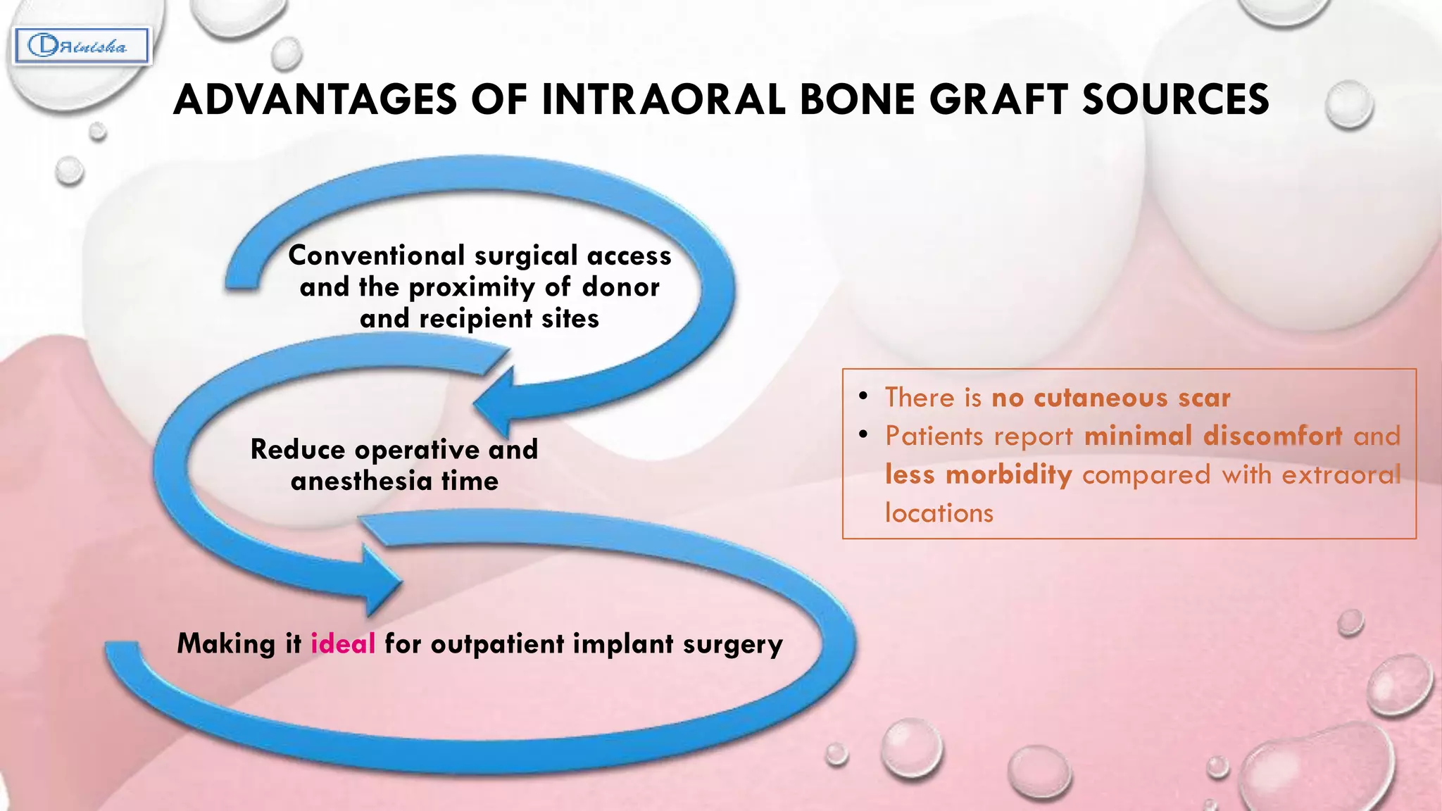 Ridge augmentation | PPTX