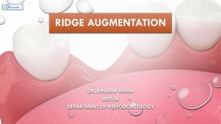 RIDGE AUGMENTATION
DR. RINISHA SINHA
MDS III
DEPARTMENT OF PERIODONTOLOGY
 