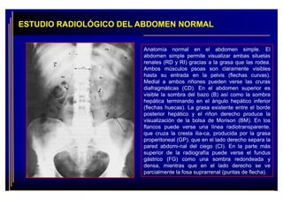 Radiologia: Abdômen simples