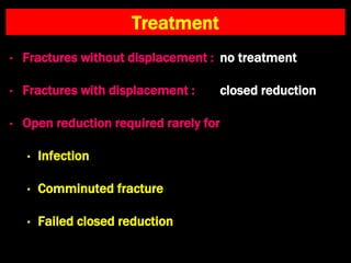 Treatment
• Fractures without displacement : no treatment
• Fractures with displacement : closed reduction
• Open reduction required rarely for
• Infection
• Comminuted fracture
• Failed closed reduction
 
