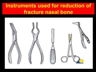 Instruments used for reduction of
fracture nasal bone
 