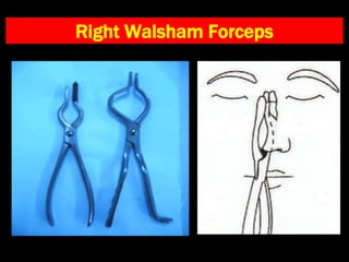 Right Walsham Forceps
 