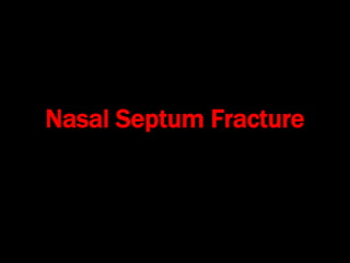 Nasal Septum Fracture
 