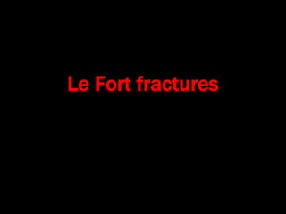 Le Fort fractures
 
