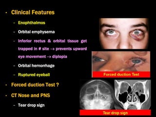 • Clinical Features
− Enophthalmos
− Orbital emphysema
− Inferior rectus & orbital tissue get
trapped in # site  prevents upward
eye movement  diplopia
− Orbital hemorrhage
− Ruptured eyeball
• Forced duction Test ?
• CT Nose and PNS
− Tear drop sign
 