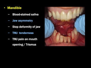 • Mandible
− Blood-stained saliva
− Jaw asymmetry
− Step deformity of jaw
− TMJ tenderness
− TMJ pain on mouth
opening / Trismus
 