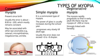 TYPES OF MYOPIA
Congenital
myopia
Present since birth
Usually the error is about -
8.00 to -10D, which mostly
remains constant.
May be associated with
other eye anomalies e.g.,
cataract, microphthalmos,
megalocornea, aniridia.
Simple myopia
It is a commonest type of
myopia.
The power of glass is usually
increases during the school
year.
progresses very slowly till
adult age.
Usually the error does not
exceed -6 to -8 diopter.
Degenerative
myopia
The myopia rapidly
progresses so that in early
adult life there may be
myopia of -20D or more.
Strongly linked with
heredity.
 