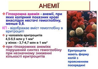 Гіпохромна анемія - анемії, при
яких колірний показник крові
внаслідок нестачі гемоглобіну,
менше 0,8.
КП - відображає вміст гемоглобіну в
еритроциті
 у чоловіків еритроцитів
4,5-5,5 млн у 1 мм³
у жінок - 3,7-4,7 млн в 1 мм³
при гіпохромних анеміях
порушений синтез гемоглобіну
при незначному зниженні
кількості еритроцитів
АНЕМІЇ
Еритроцити
мають форму
колій з
проясненням
посередині
 