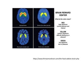 https://www.thinwomanbrain.com/the-food-addicts-brain.php
 