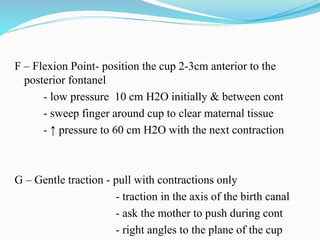 F – Flexion Point- position the cup 2-3cm anterior to the
posterior fontanel
- low pressure 10 cm H2O initially & between cont
- sweep finger around cup to clear maternal tissue
- ↑ pressure to 60 cm H2O with the next contraction
G – Gentle traction - pull with contractions only
- traction in the axis of the birth canal
- ask the mother to push during cont
- right angles to the plane of the cup
 
