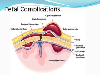 Fetal Complications
 
