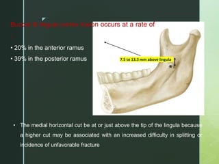 z
• The medial horizontal cut be at or just above the tip of the lingula because
a higher cut may be associated with an increased difficulty in splitting or
incidence of unfavorable fracture
7.5 to 13.3 mm above lingula
Buccal & lingual cortex fusion occurs at a rate of
:
• 20% in the anterior ramus
• 39% in the posterior ramus
 