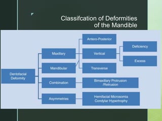 z
Classifcation of Deformities
of the Mandible
 