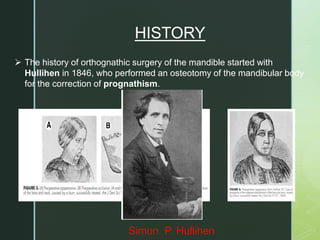  The history of orthognathic surgery of the mandible started with
Hullihen in 1846, who performed an osteotomy of the mandibular body
for the correction of prognathism.
Simon. P. Hullihen
HISTORY
 