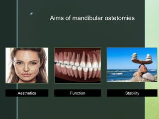 z
Aims of mandibular ostetomies
Aesthetics Function Stability
 