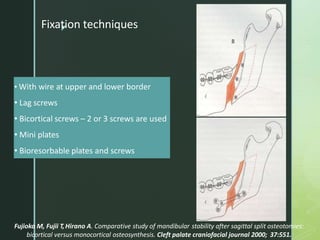 z
• With wire at upper and lower border
• Lag screws
• Bicortical screws – 2 or 3 screws are used
• Mini plates
• Bioresorbable plates and screws
Fujioka M, Fujii T,Hirano A. Comparative study of mandibular stability after sagittal split osteotomies:
bicortical versus monocortical osteosynthesis. Cleft palate craniofacial journal 2000; 37:551.
Fixation techniques
 