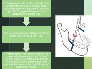 The osteotome should be twisted in the
direction that the distal portion of the
proximal segment is opened & the distal
tips of both proximal segments are
rotated to the buccal side.
This prevents manual twisting force from
being transferred to the TMJ.
Twisting starts from anterior portion of
proximal segments just behind the
vertical buccal osteotome. Splitting by
manual twist force extends from the
mandibular angle to the post. Border of
ascending ramus.
 