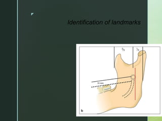 z
Identification of landmarks
 