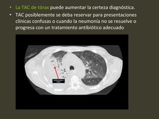 • La TAC de tórax puede aumentar la certeza diagnóstica.
• TAC posiblemente se deba reservar para presentaciones
clínicas confusas o cuando la neumonía no se resuelve o
progresa con un tratamiento antibiótico adecuado
 