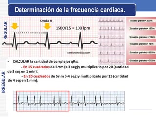 Determinación de la frecuencia cardíaca.
REGULAR
IRREGULAR
 