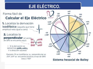 EJE ELÉCTRICO.
 