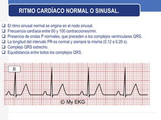  El ritmo sinusal normal se origina en el nodo sinusal.
 Frecuencia cardíaca entre 60 y 100 contracciones/min.
 Presencia de ondas P normales, que preceden a los complejos ventriculares QRS.
 La longitud del intervalo PR es normal y siempre la misma (0.12 a 0.20 s).
 Complejo QRS estrecho.
 Equidistancia entre todos los complejos QRS.
RITMO CARDÍACO NORMAL O SINUSAL.
 