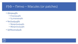 Բիծ – Пятно – Macules (or patches)
• Անոթային
• Բորբոքային
• Ոչ բորբոքային
• Գունակային
• Գերգունակային
• Թերգունակային
• Արհեստական
 