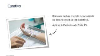 Curativo
• Remover bolhas e tecido desvitalizado
no centro cirúrgico sob anestesia.
• Aplicar Sulfadiazina de Prata 1%.
 