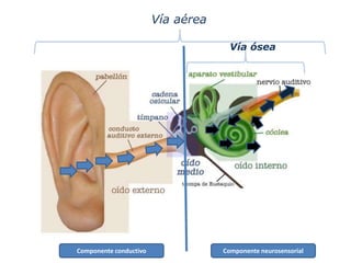 Componente conductivo Componente neurosensorial
Vía aérea
Vía ósea
 