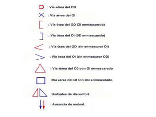 SIMBOLOS EN AUDIOMETRIA
 