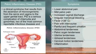 2 / 1 1 / 2 0 2 4
47
Pelvic Inflammatory Disease (PID)
• a clinical syndrome that results from
the ascension of microorganisms
from the cervix and vagina to the
upper genital tract. PID is a serious
complication of chlamydia and
gonorrhea, two of the most common
reportable infectious diseases and
sexually transmitted diseases (STDs)
in the US.
Symptoms:
• Lower abdominal pain
• Mild pelvic pain
• Increased vaginal discharge
• Irregular menstrual bleeding
• Fever (>38° C)
• Pain with intercourse
• Painful and frequent urination
• Abdominal tenderness
• Pelvic organ tenderness
• Uterine tenderness
• Adnexal tenderness
• Cervical motion tenderness
• Inflammation
 