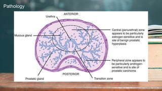 2 / 1 1 / 2 0 2 4
54
Pathology
 