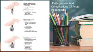 2 / 1 1 / 2 0 2 4
8
Pathogenesis And
Complications Of Acute
Appendicitis
 