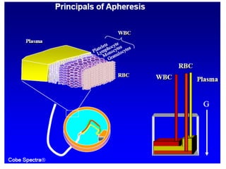 11. Lecture Apheresis by Riaz.pdf what is apheresis written precisely | PDF