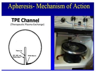 11. Lecture Apheresis by Riaz.pdf what is apheresis written precisely | PDF