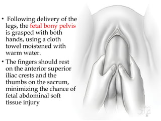 31
• Following delivery of the
legs, the fetal bony pelvis
is grasped with both
hands, using a cloth
towel moistened with
warm water.
• The fingers should rest
on the anterior superior
iliac crests and the
thumbs on the sacrum,
minimizing the chance of
fetal abdominal soft
tissue injury
 