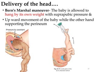 Delivery of the head….
• Bern's Marshal maneuver- The baby is allowed to
hang by its own weight with suprapubic pressure &
• Up ward movement of the baby while the other hand
supporting the perineum
37
 