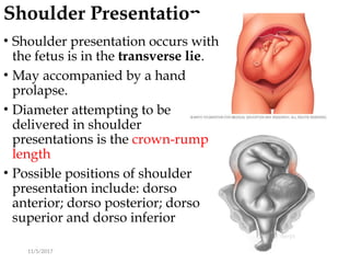 Shoulder Presentation
11/5/2017 62
• Shoulder presentation occurs with
the fetus is in the transverse lie.
• May accompanied by a hand
prolapse.
• Diameter attempting to be
delivered in shoulder
presentations is the crown-rump
length
• Possible positions of shoulder
presentation include: dorso
anterior; dorso posterior; dorso
superior and dorso inferior
 