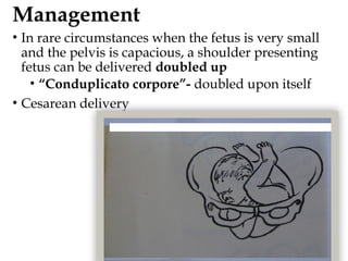 Management
• In rare circumstances when the fetus is very small
and the pelvis is capacious, a shoulder presenting
fetus can be delivered doubled up
• “Conduplicato corpore”- doubled upon itself
• Cesarean delivery
 