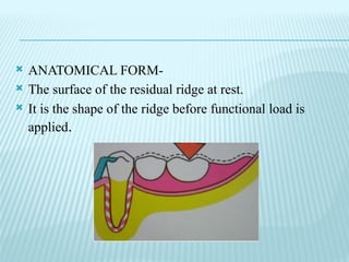 11.Special Impression Procedures For TooTH-Tissue-Supported removable ...