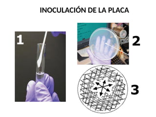 INOCULACIÓN DE LA PLACA
1 2
3
 