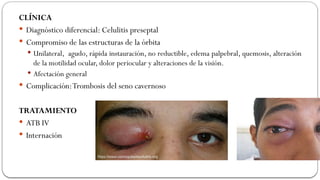 Orbiita anatomía y funcionalidad y factores.pptx
