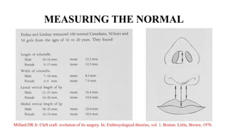 management of Cleft Lip, management of cleft lip and palate | PPTX
