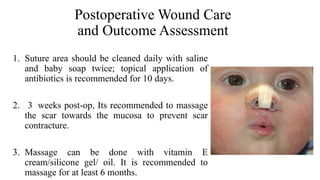 management of Cleft Lip, management of cleft lip and palate | PPTX