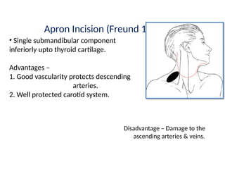 Neck Dissection Incision Apron Neck Dissection for Oral Squamous cell carcinoma.pptx