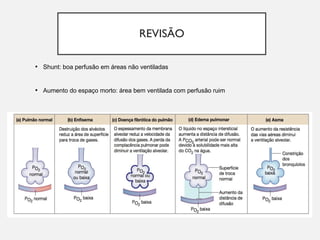 REVISÃO
• Shunt: boa perfusão em áreas não ventiladas
• Aumento do espaço morto: área bem ventilada com perfusão ruim
 