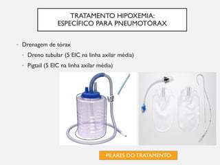 TRATAMENTO HIPOXEMIA:
ESPECÍFICO PARA PNEUMOTÓRAX
• Drenagem de tórax
• Dreno tubular (5 EIC na linha axilar média)
• Pigtail (5 EIC na linha axilar média)
PILARES DO TRATAMENTO
 