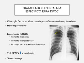 TRATAMENTO HIPERCAPNIA:
ESPECÍFICO PARA DPOC
• Obstrução fixa da via aérea causada por enfisema e/ou bronquite crônica
• Efeito espaço morto
• Exacerbação (GOLD)
• VNI: BIPAP ( mortalidade)
• Tratar a doença
• Aumento de dispneia
• Aumento da expectoração
• Mudança nas caracterís5cas do escarro
 